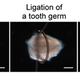 Illustration for article titled Were One Step Closer to Being Able to Regrow a Lost Tooth